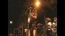 Scars on broadway – Funny