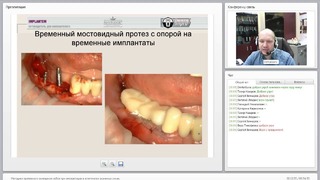 Вебинар: Методики временного замещения зубов при имплантации в эстетически зонах