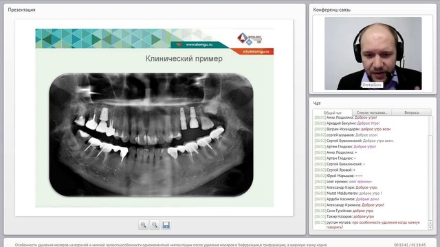 Вебинар: Особенности удаления моляров на верхней и нижней челюсти
