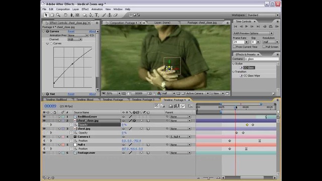 Видеоурок по After Effects и 3DMAX /Медицинское увеличение часть 3