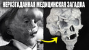 Как Человек Слон Бросил Вызов Всей Медицине