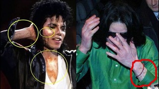 Почему Майкл Джексон мутировал в белый цвет