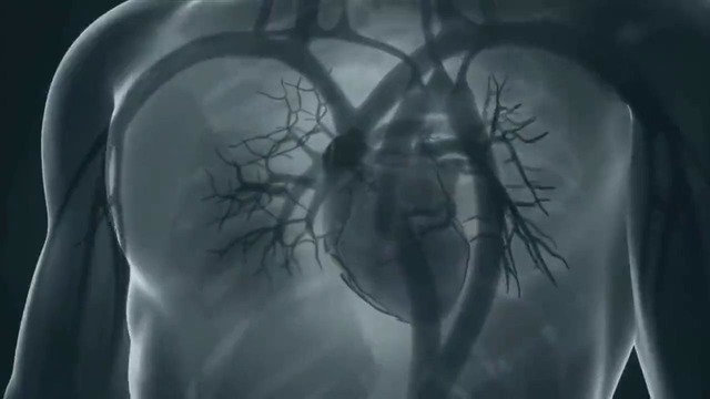 Fantom – Жуткий случай облучения радаром