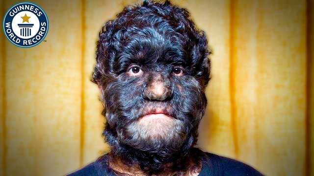 The World’s Hairiest Family – Guinness World Records