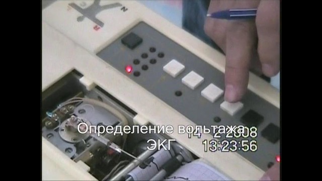 Нормальная экг