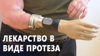 Бионическая рука нового типа избавила пациентку от фантомных болей