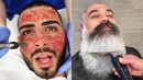 На что готовы мужчины ради красоты – 20