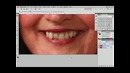 PhotoshopCafe Les – 06 Fix Teeth