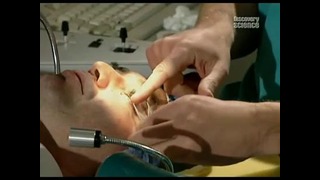 Лазерная хирургия глаз «Как это работает»