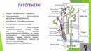 4 курс. Факультет педиатрия. Сурункали гломерулонефрит