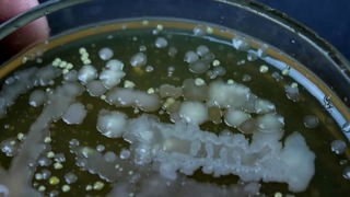 Вырастил бактерии с денег в чашке петри. сколько бактерий на лапах енота хайпа