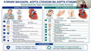 АОРТАЛ НУКСОНЛАР