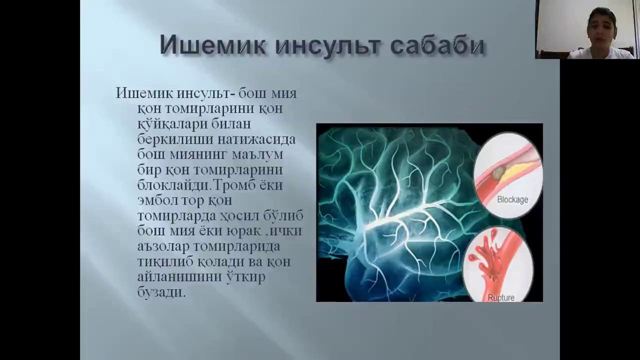 Правосторонний ишемический инсульт головного мозга. Причины ишемического инсульта. Предпосылки ишемического инсульта. Ишемический инсульт причины возникновения. Причины ишемического инсульта головного мозга.