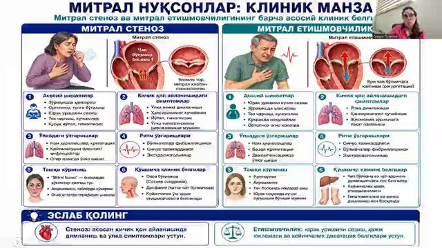 МИТРАЛ НУКСОНЛАР