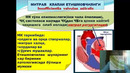 4 курс, Факультет ички касалликлар Митрал нуқсонлар – Абдуллаев А.Х