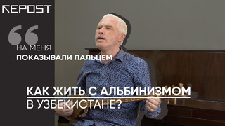 Жизнь альбиноса в Узбекистане — с какими проблемами он сталкивается? / Люди / RepostTV