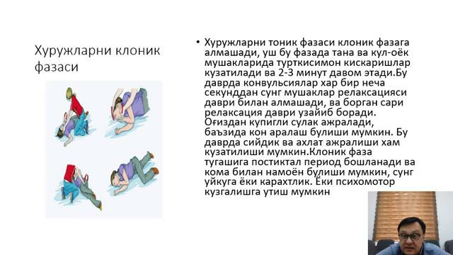 Эпилепсияда рухий ўзгаришлар