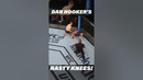 Dan Hooker Has NASTY Knees!! #ufc #mma #fighter