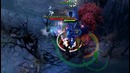 Dota 2 Daily WTF 151 – How to play Doto