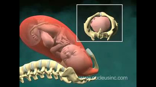 Рождение ребенка в 3D
