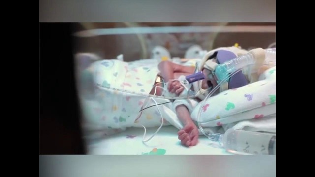 3.5 oylik tug’ilgan chaqaloq! Mo’jiza