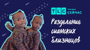 Разделение сиамских сестер | Доминиканские близнецы | TLC