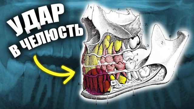 Почему Удар в Челюсть Приводит к Нокауту