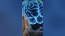 Neuralink начинает чипирование