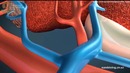 Buyrak transplantatsiyasi. 3D animatsion film