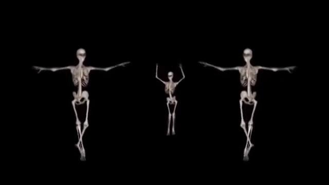 Восточные танцы глазами рентгенолога