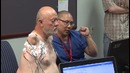 Человек-киборг: учёным удалось вернуть ампутанту обе руки