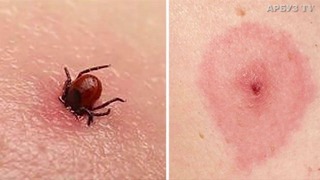 10 укусов насекомых, которые нужно знать каждому