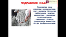 8-Gidravlik bog’lovchilar, gidravlik ohak va Romansement, turlari