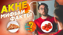 АКНЕ: причины, мифы. ПИТАНИЕ и ДИЕТА помогут? Углеводы, гигиена. Прыщи, черные точки