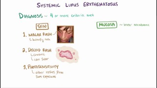 Системная Красная Волчанка / Systemic Lupus Erythematosus (SLE)