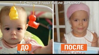 12 фото малышей до и после того, как их забрали из детского дома