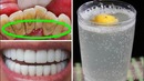 Как быстро отбелить зубы в домашних условиях