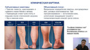 Unit 26. Тема 14. Заболевания вен нижних конечностей. Варикозная болезнь