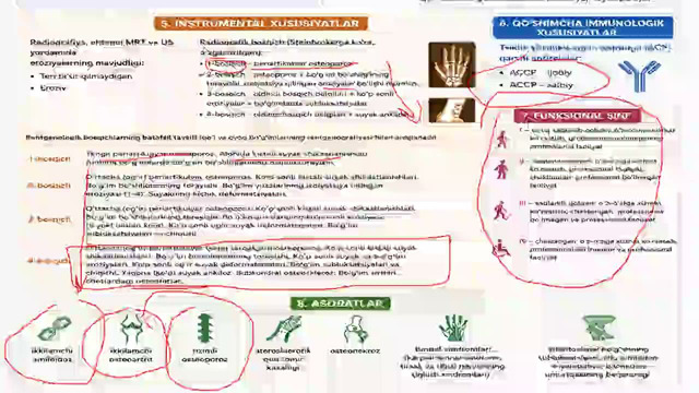 Revmatoid artrit – Rasulev Yo.E