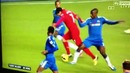 John Terry injury against Liverpool 11-11-12