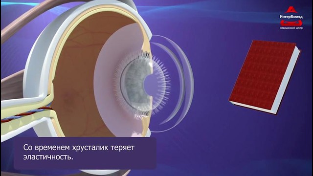 Глазные заболевания