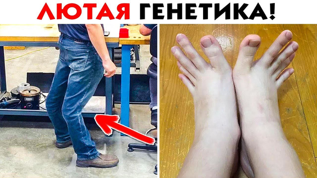 45 лютых генетических мутаций человеческого тела