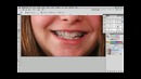 PhotoshopCafe Les – 07 Remove Braces