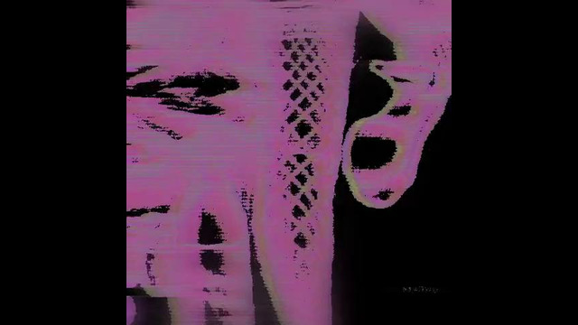 OCCVLT X UNFAIR – U NEED 2 REST