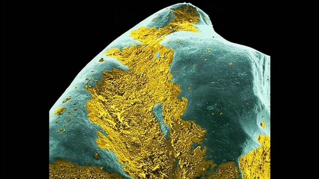 Бактерии, живущие во рту человека – Интересные факты