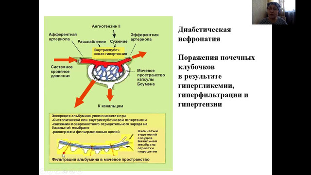 Осложнения сахарного диабета