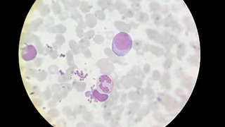 Микроскопия крови лейкоцитарная формула