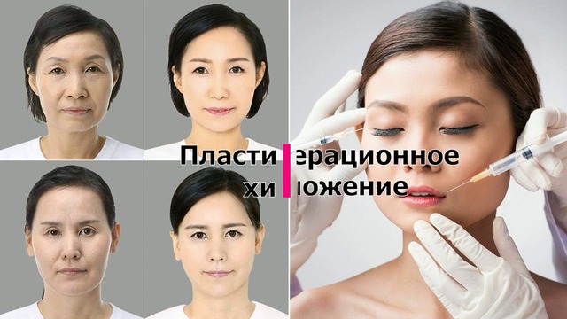 Лечение в Южной Корее. Ташкент, Узбекистан