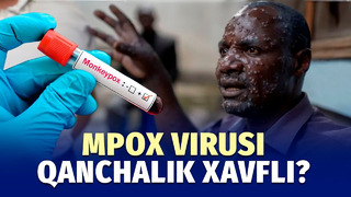 Mpox virusi haqida nimalarni bilish kerak