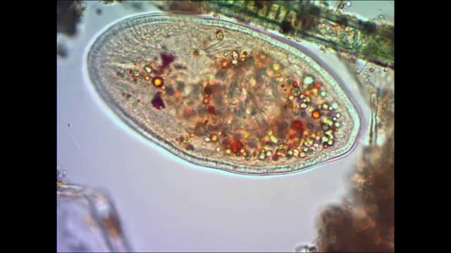 Инфузория туфелька под микроскопом under microscope